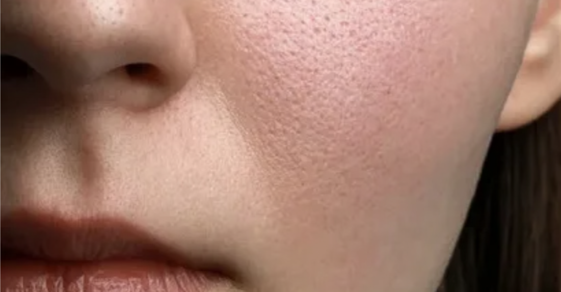 Уход за кожей лица